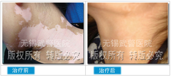 患者治疗前1.jpg